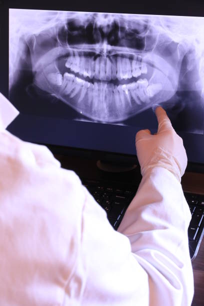 Best Emergency Dental Care for Abscessed Tooth in London, CA