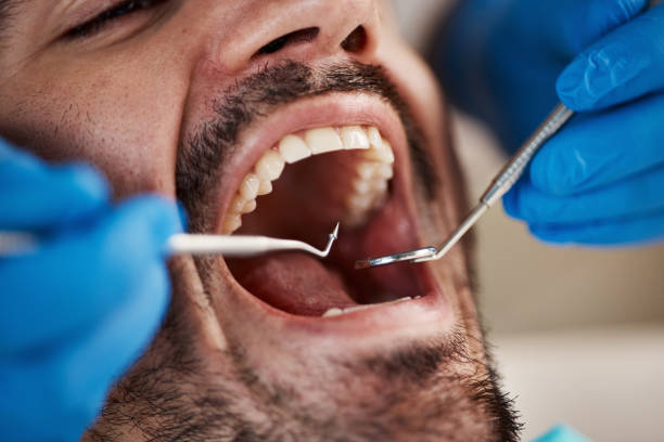 Best Holiday Emergency Dentist in London, CA
