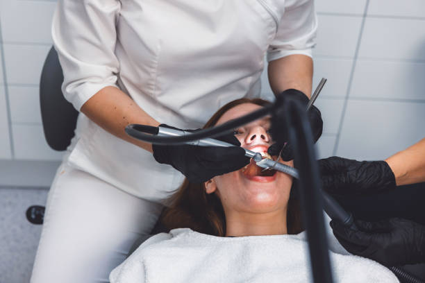 Best Emergency Dental Extractions in London, CA