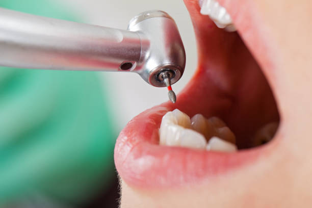 Best Mobile Emergency Dentist in London, CA